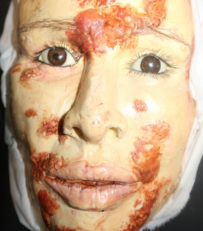 University figure to teach dermatology University figure to teach dermatology